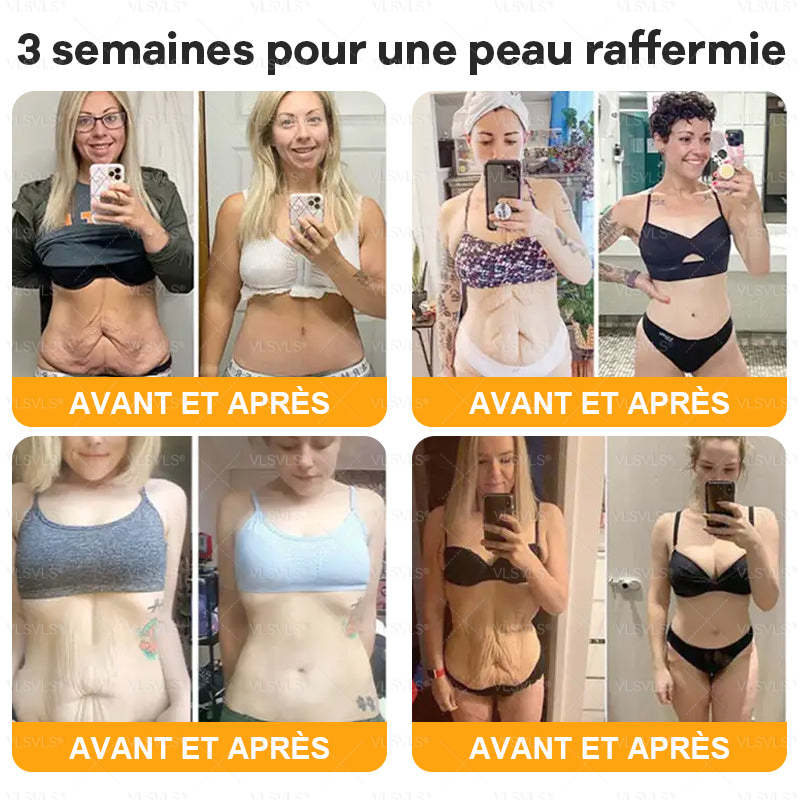Fabriqué et expédié de France 👑👑👑Crème complète au Venin d’Abeille VLSVLS® 🔥 DERNIER JOUR -80%