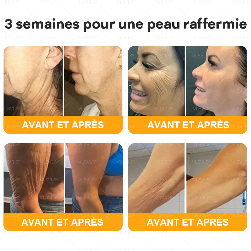 Fabriqué et expédié de France 👑👑👑Crème complète au Venin d’Abeille VLSVLS® 🔥 DERNIER JOUR -80%